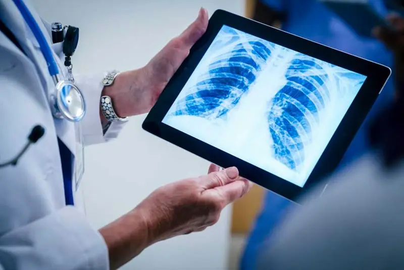 GAMCA Chest X-Ray - Tuberculosis TB Screening and Lung Health Check for GCC Countries